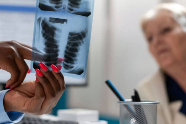 Pneumonia em idosos: por que os sinais atípicos merecem atenção